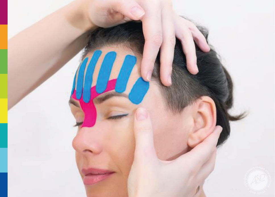 тейпирование